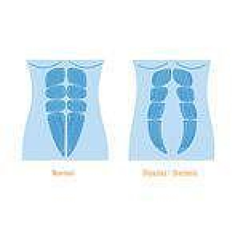 Следродилен регулируем колан